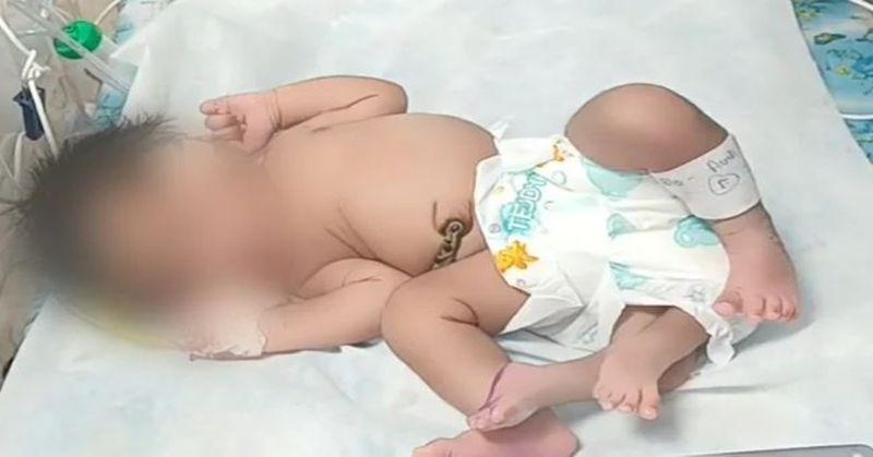 Snimak novorođenčeta obilazi svijet: Djevojčica rođena s četiri noge