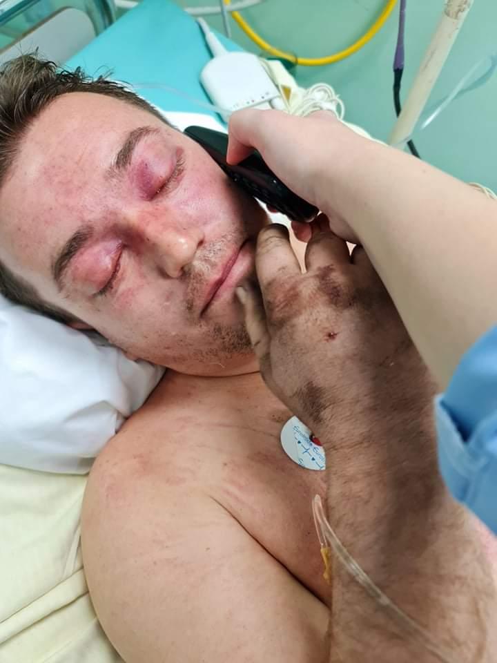 Hasan Kadirić u bolnici nakon nesreće - Avaz