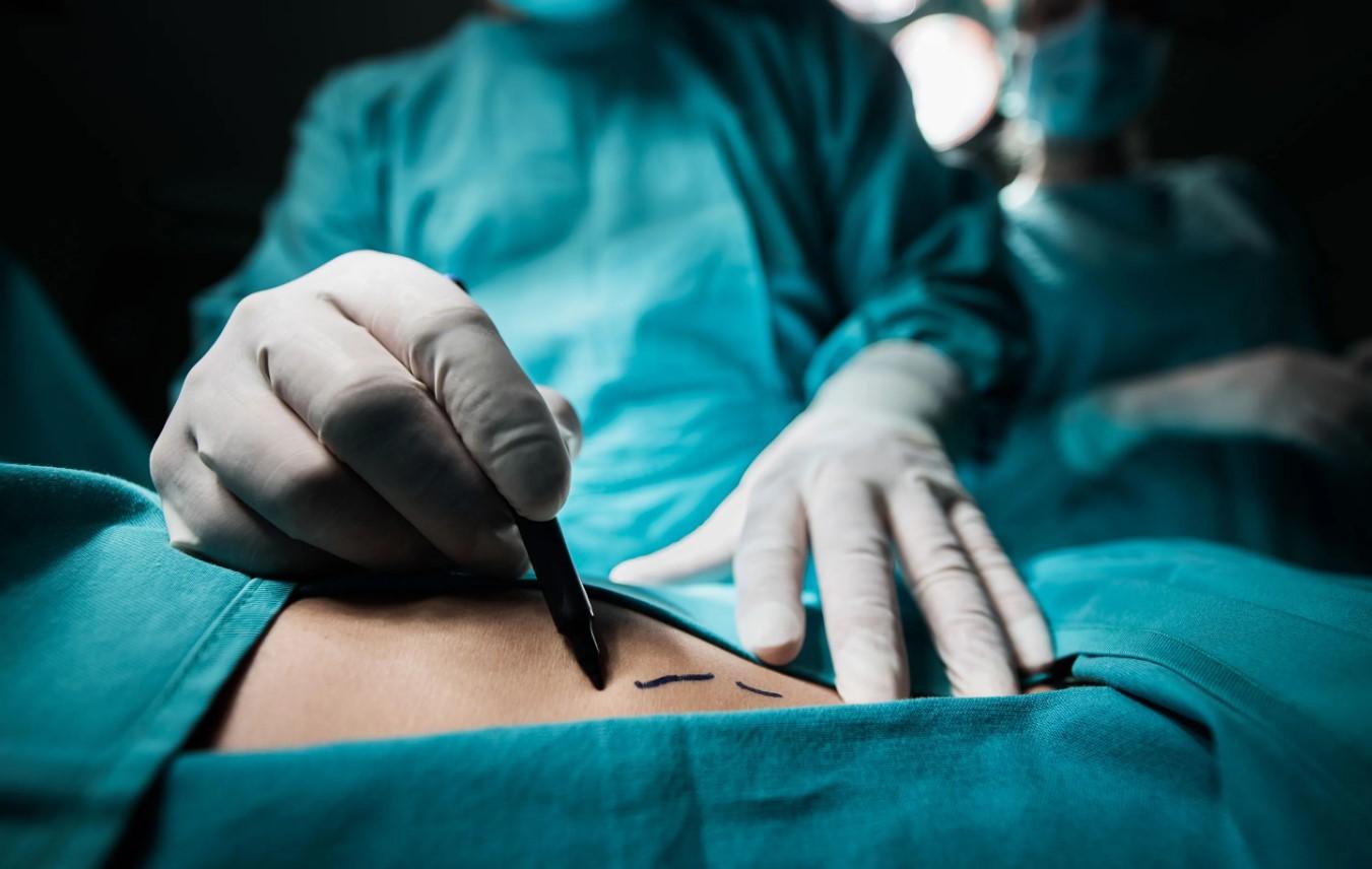 Žena preminula poslije operacije smanjenja grudi: Radila intervenciju u privatnoj klinici