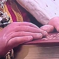 Fotografija otečenih prstiju kralja Čarlsa uzrokovala zabrinutost za njegovo zdravlje