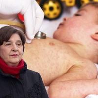 Epidemiologinja Zarema Obradović za "Avaz": Zbog dezinformacija, roditelji ne vakcinišu djecu protiv morbila