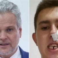 Delegacija EU u BiH: Zgroženi smo napadom huligana na Osmana Mehanovića u Bratuncu