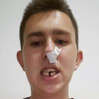 U Bratuncu pretučen mladić Osman Mehanović: Zadobio teške tjelesne povrede