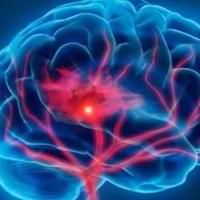 Poslije 40. godine mozak se dramatično mijenja: U srednjim godinama javljaju se prvi znaci demencije