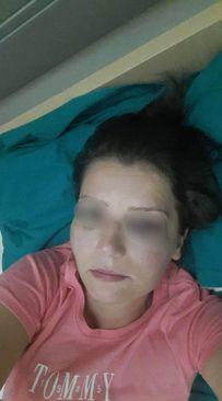 Klepo: Zadobila povrede od udaraca u glavu  - Avaz