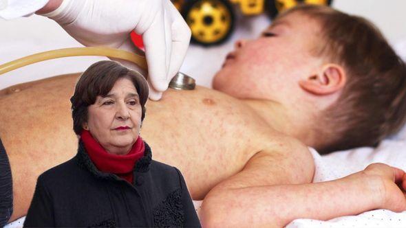 Obradović: Broj djece vakcinisane u KS je nizak - Avaz