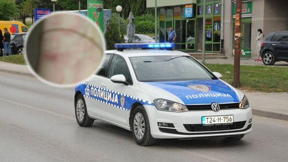 Policiji prijavljeno slučaj - Avaz