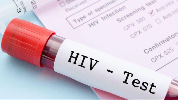HIV - Avaz