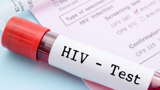 Svjetski dan borbe protiv HIV-a: Kako se prenosi infekcija i koje radnje vas neće ugroziti