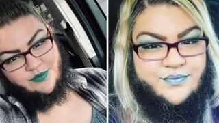 Zbog rijetke bolesti raste joj duga brada: ''Svi mi govore da je obrijem, ali mom momku se sviđa''