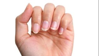 Evo šta boja noktiju govori o vašem zdravlju: Crni nokti ukazuju na bolesti srca