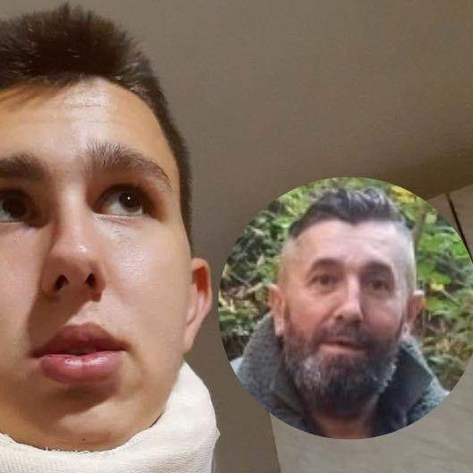 Hazir Mehanović, otac pretučenog mladića iz Bratunca, za "Avaz": Izboli su ga, slomili mu nos i izbili zub