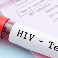 Naučnici uspješno uklonili HIV iz zaraženih ćelija