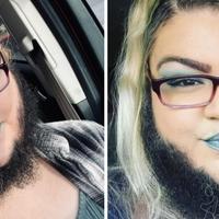 Zbog rijetke bolesti raste joj duga brada: ''Svi mi govore da je obrijem, ali mom momku se sviđa''