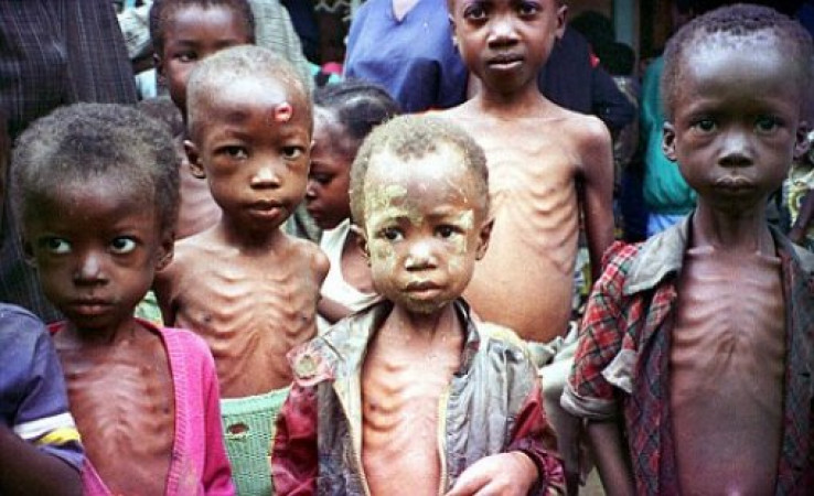 Rezultat slika za upit "glad u svijetu"