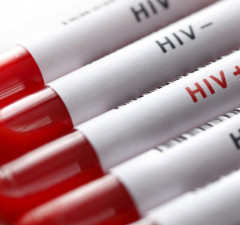 Uspješno blokira  vezivanje HIV-a za ćelije imunosnog sistema