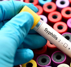 Pozitivan na Sifilis