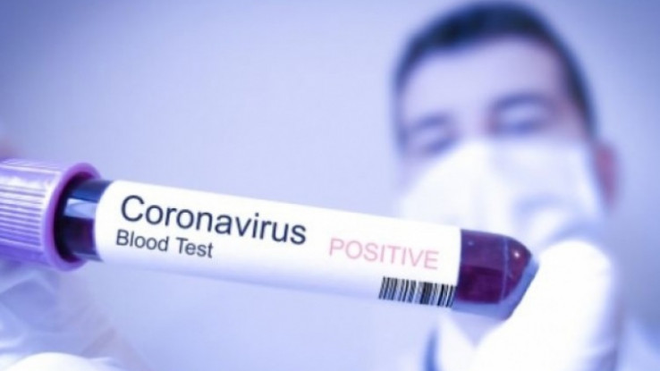 Preventivne mjere zbog širenja koronavirusa  - Avaz, Dnevni avaz, avaz.ba