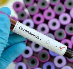 U Srbiji zaražena 41 osoba koronavirusom 
