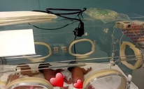 Bebe se nalaze u inkubatoru, a nakon par sedmica će ići kući