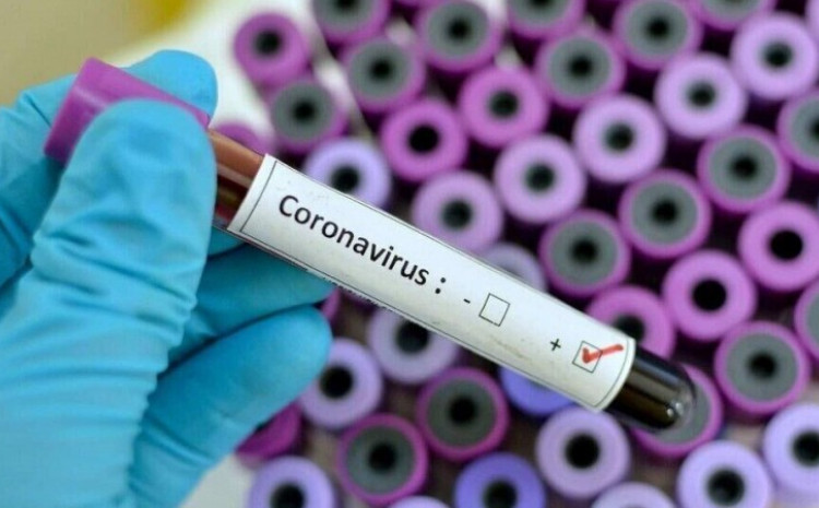 U protekla 24 sata obavljena su 143.332 testiranja na koronavirus