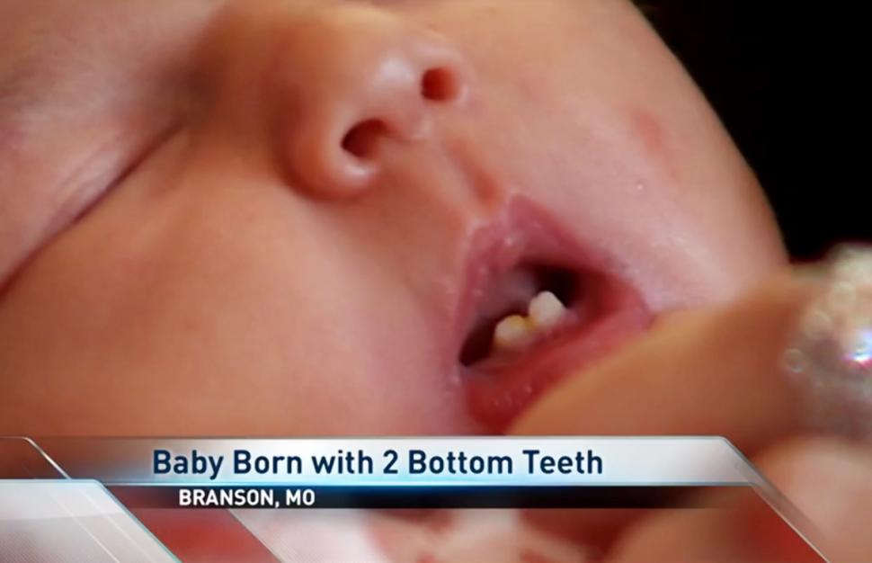 teeth9n-2-web